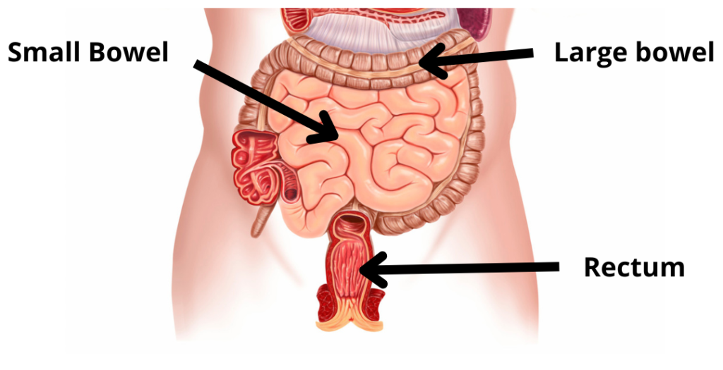 a36cc5 071 1ebc fddb 31eac356a86 Orange and Black Simple Quote World Health Day Instagram Post 3